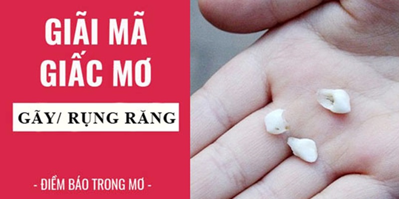 Nằm mơ thấy rụng răng